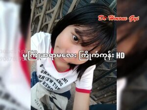 Thumb 1